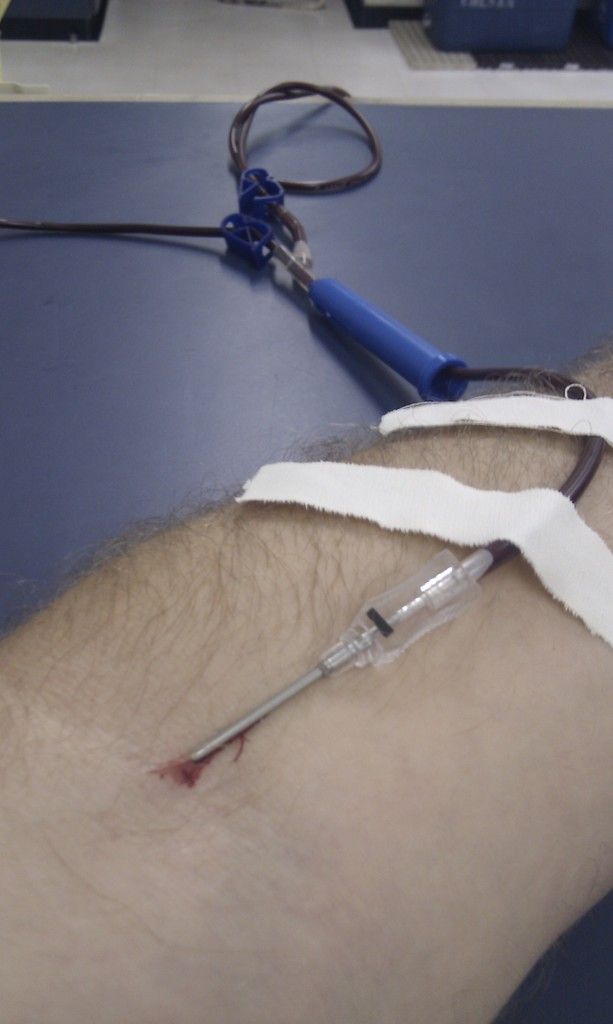 Laryngoscopy Exploration: Meaning, What You'll Encounter, and Further Details