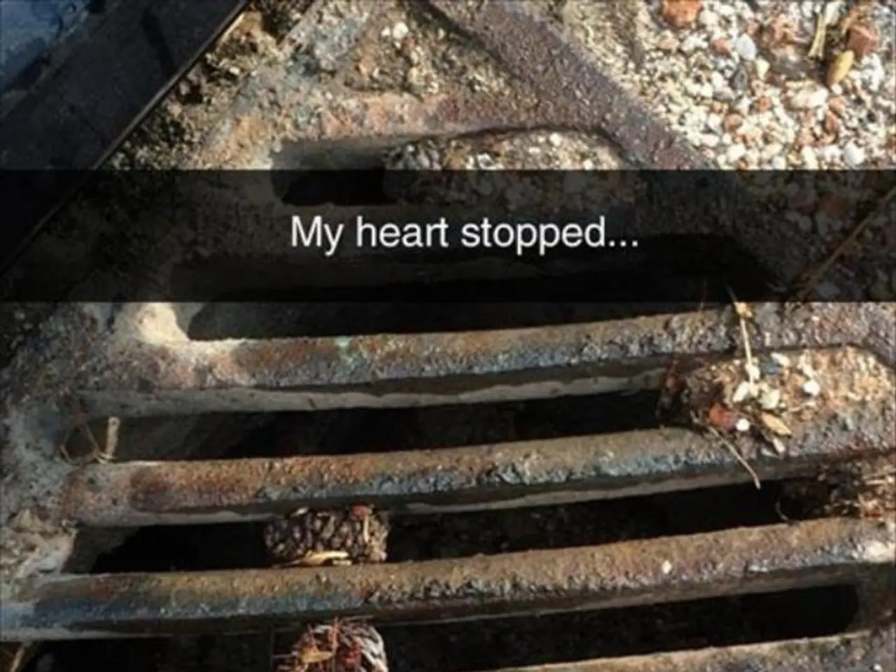 Heart Failure Explained: A Comprehensive Look at Cardiac Dysfunction