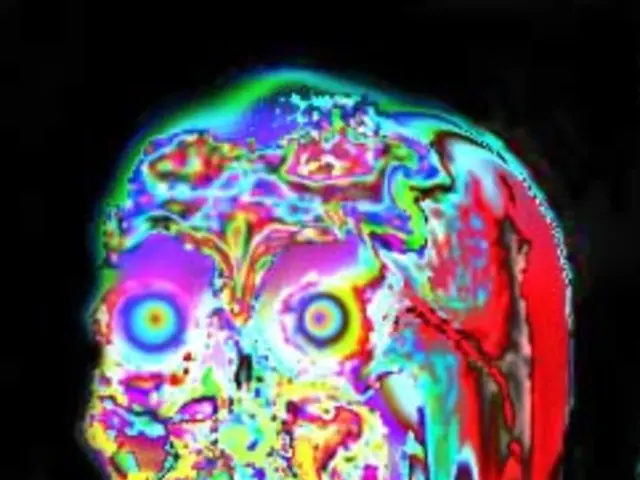 Subdural hemorrhage: Exploration, remedy, and prognosis