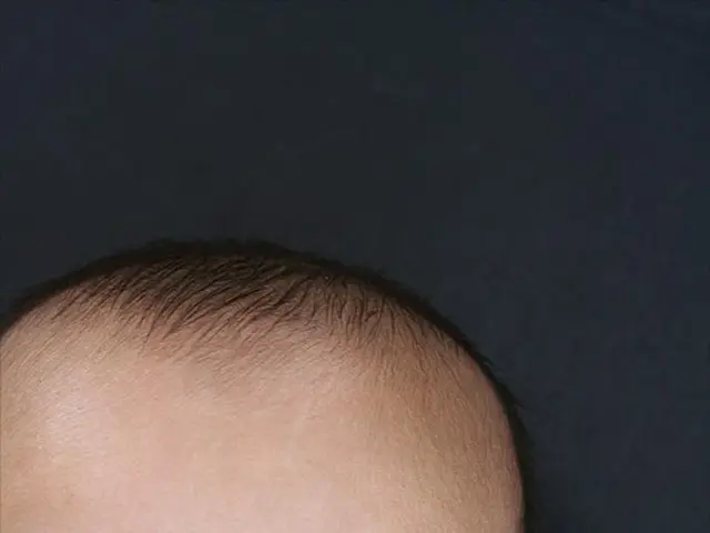 Week 6 Pregnancy: Symptoms, Hormonal Changes, and Fetus Development