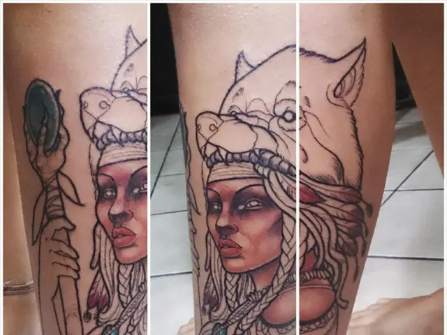 Inner Thigh Boils: Symptoms, Causes, and Remedies