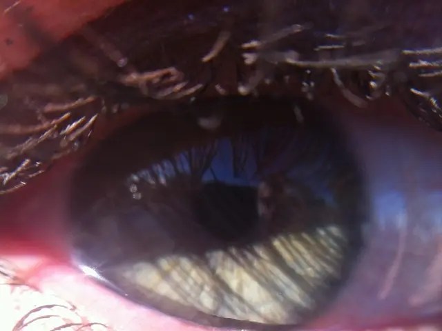 Alleviating Eye Discomfort Instantly