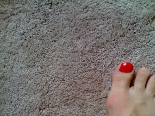 Foot ailments: Understanding hammer, claw, and mallet toes