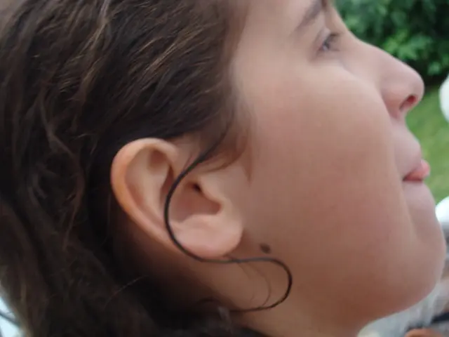 Appearance of Genital Warts and Associated Signs, as well as Remedial Measures