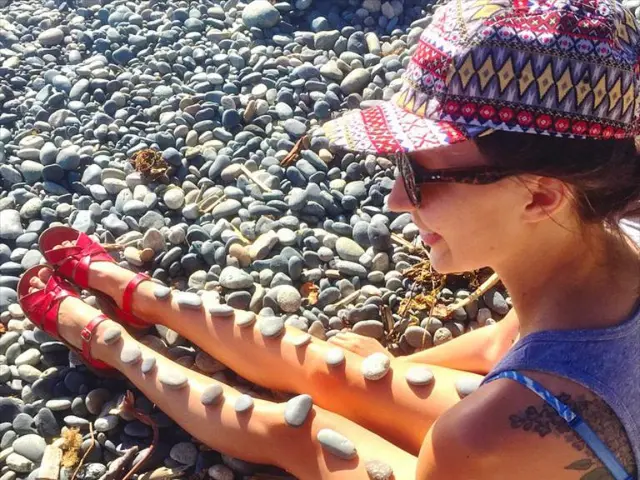 Urologist shares advice on preventing kidney stones during hot weather