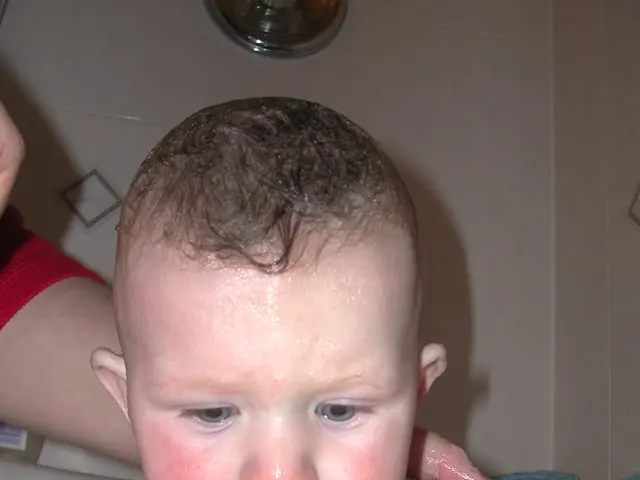 Babies Experiencing Swollen Kidneys: Understanding Root Causes, Symptoms, and Remedies