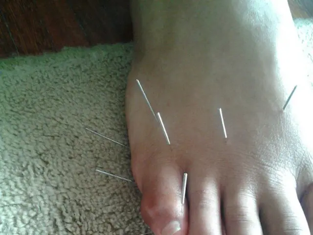 Differences and Distinct Features of Arterial and Venous Ulcers Revealed