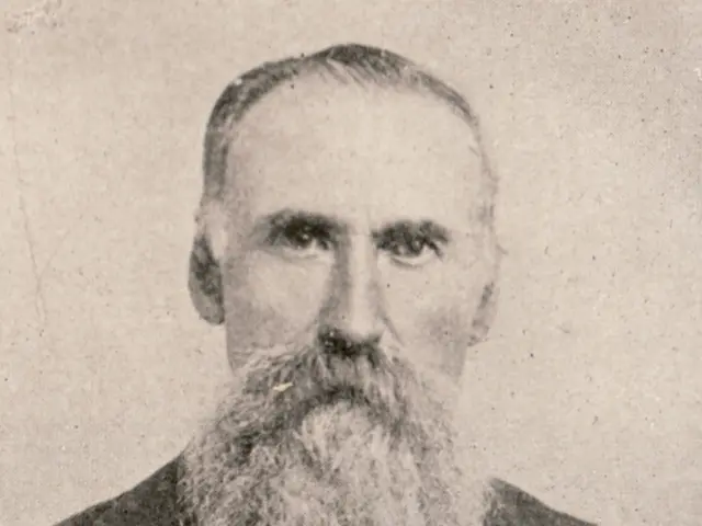 Desiring to Tackle Beard Psoriasis? Learn Effective Management Strategies Here